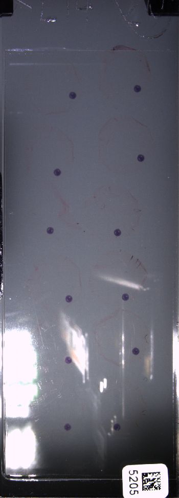 Media type: image; Special Collections 4011   shows specimen_part histological serial section;